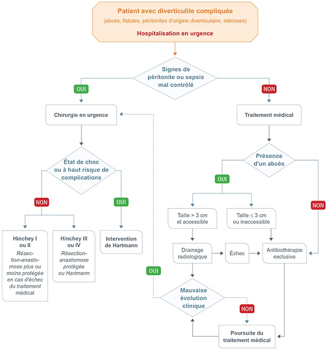 diverticulite compliquee 650px