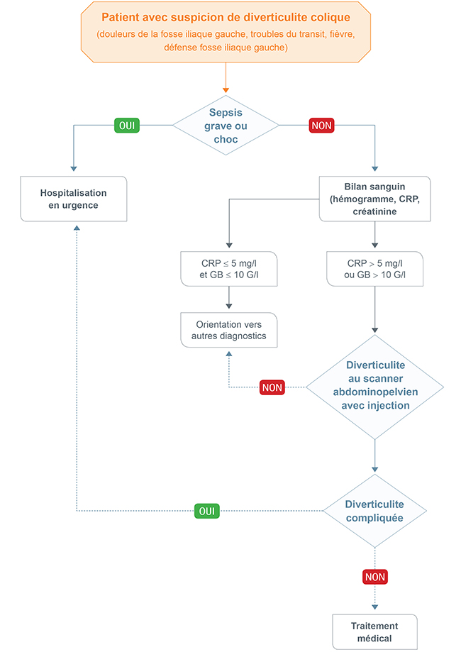 diverticulite non compliquee 650px
