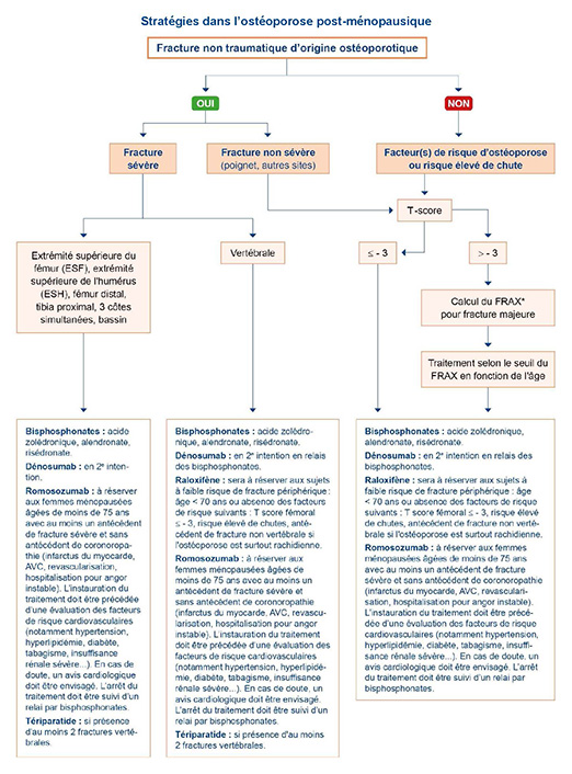 Stratégies dans l'ostéoporose post-ménopausique - schéma